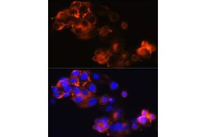 Immunofluorescence analysis of HepG2 cells using Glypican 3 (GPC3) (GPC3) Rabbit mAb (ABIN7267487) at dilution of 1:100 (40x lens). (Glypican 3 抗体)