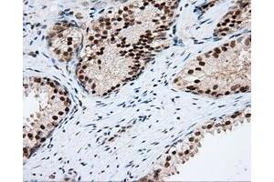 Immunohistochemical staining of paraffin-embedded Kidney tissue using anti-RC201933 mouse monoclonal antibody. (PIM2 抗体)