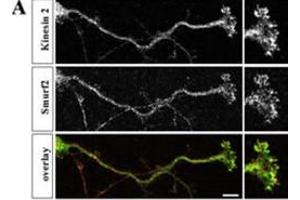 Hippocampal neurons were fixed at stage 3, stained with anti-Smurf2 (red) and anti-Kinesin-2 (green) antibodies, and analyzed by confocal microscopy. (SMURF2 抗体  (C-Term))