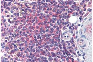 Human Spleen: Formalin-Fixed, Paraffin-Embedded (FFPE) (EDC4 抗体  (AA 1302-1402))