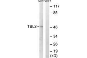 Western blot analysis of extracts from MCF-7 cells, using TBL2 Antibody. (TBL2 抗体  (AA 381-430))