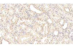 Detection of NOS2 in Human Kidney Tissue using Monoclonal Antibody to Nitric Oxide Synthase 2, Inducible (NOS2) (NOS2 抗体  (AA 533-696))