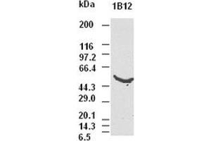 CK8 antibody (1B12) at 1:5000 dilution + Hela cell lysate (KRT8 抗体  (AA 91-381))