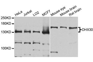 Western blot analysis of extracts of various cell lines, using DHX30 antibody (ABIN5996443) at 1/1000 dilution. (DHX30 抗体)