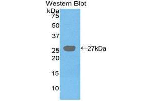 Western Blotting (WB) image for anti-Diacylglycerol O-Acyltransferase 1 (DGAT1) (AA 180-427) antibody (ABIN1858627) (DGAT1 抗体  (AA 180-427))