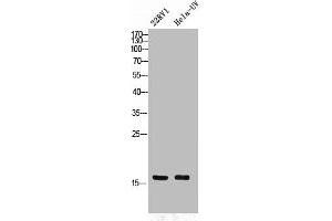 Western Blot analysis of 22RV1 HELA cells using Phospho-p16 (S326) Polyclonal Antibody (CDKN2A 抗体  (pSer326))