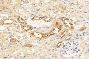 Immunohistochemistry analysis of paraffin-embedded human kidney using,TMEM213 (ABIN7075999) at dilution of 1: 2000 (TMEM213 抗体)