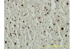 Image no. 1 for anti-Adrenocortical Dysplasia Homolog (ACD) (AA 1-545) antibody (ABIN599297) (ACD 抗体  (AA 1-545))