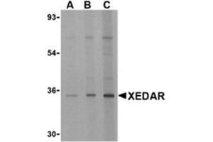 Image no. 1 for anti-Ectodysplasin A2 Receptor (EDA2R) antibody (ABIN318757) (Ectodysplasin A2 Receptor 抗体)