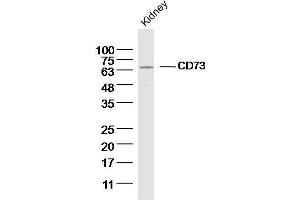 Mouse kidney lysates probed with CD73 Polyclonal Antibody, unconjugated  at 1:300 overnight at 4°C followed by a conjugated secondary antibody for 60 minutes at 37°C. (CD73 抗体  (AA 151-250))