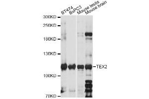 Western blot analysis of extracts of various cell lines, using TEX2 antibody (ABIN6293661) at 1:1000 dilution. (TEX2 抗体)