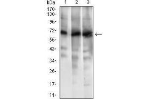 Western blot analysis using ABCG5 mouse mAb against HL7702 (1), RAJI (2) and Jurkat (3) cell lysate.
