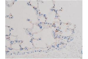 Immunohistochemistry (IHC) image for anti-V-Akt Murine Thymoma Viral Oncogene Homolog 1 (AKT1) (pThr450) antibody (ABIN6256564)