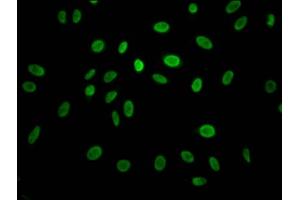 Immunofluorescence staining of Hela Cells with ABIN7127442 at 1:50, counter-stained with DAPI. (Recombinant Cyclin E1 抗体)