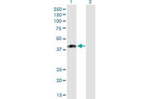 Western Blot analysis of SPG11 expression in transfected 293T cell line by SPG11 MaxPab polyclonal antibody. (SPG11 抗体  (AA 1-425))