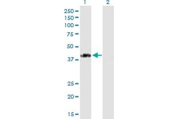 SPG11 anticorps  (AA 1-425)