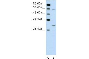 WB Suggested Anti-GAMT Antibody Titration:  0. (GAMT 抗体  (N-Term))