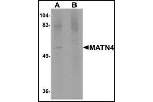 Western blot analysis of MATN4 in rat brain tissue lysate with this product at 1 μg/ml in (A) the absence and (B) the presence of blocking peptide. (MATN4 抗体  (N-Term))