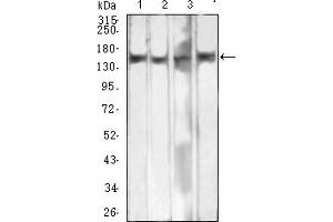 Western Blotting (WB) image for anti-MutS Homolog 6 (E. Coli) (MSH6) (AA 217-395) antibody (ABIN7193511)