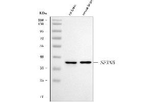 Western blot analysis of SFXN5 using anti-SFXN5 antibody (ABIN7601388). (Sideroflexin 5 抗体  (AA 34-340))