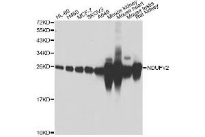 Western blot analysis of extracts of various cell lines, using NDUFV2 antibody (ABIN4904507) at 1:1000 dilution. (NDUFV2 抗体)