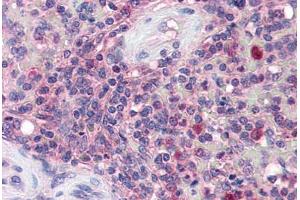 Human Spleen (formalin-fixed, paraffin-embedded) stained with KPNB1 antibody ABIN337256 at 5 ug/ml followed by biotinylated anti-goat IgG secondary antibody ABIN481715, alkaline phosphatase-streptavidin and chromogen. (KPNB1 抗体  (AA 851-863))