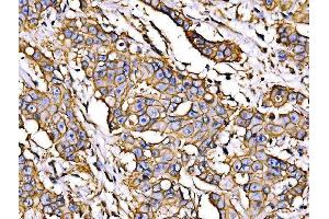 IHC analysis of ATP1B1 using anti-ATP1B1 antibody (ABIN7602014).