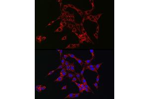 Immunofluorescence analysis of PC-12 cells using HB-EGF Rabbit pAb (ABIN6130449, ABIN6141644, ABIN6141645 and ABIN6218793) at dilution of 1:150 (40x lens).