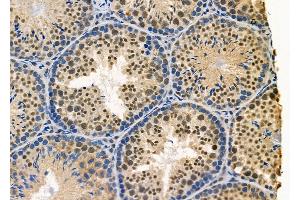 ABIN6265384 and ABIN6278405 at 1/100 staining Mouse testis tissue by IHC-P. (SUV39H1 抗体  (C-Term))