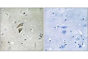 Immunohistochemistry analysis of paraffin-embedded human brain tissue, using RNF149 Antibody. (RNF149 抗体  (AA 211-260))