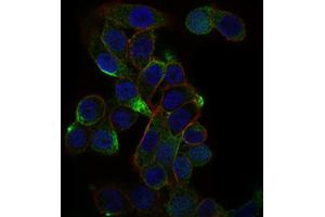 Immunofluorescence analysis of Hela cells using CD59 antibody (green). (CD59 抗体  (AA 31-111))