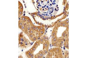 Immunohistochemical analysis of paraffin-embedded M. (AK4 抗体  (AA 119-153))