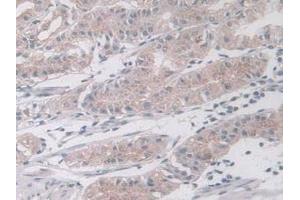 IHC-P analysis of Human Liver Tissue, with DAB staining. (MAPK12 抗体  (AA 27-311))