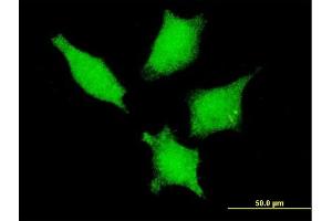 Immunofluorescence of monoclonal antibody to DDX20 on HeLa cell. (DDX20 抗体  (AA 725-824))