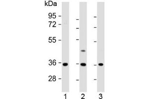Western blot testing of human 1) U-87 MG, 2) U-2 OS and 3) MDA-MB-231 cell lysate with OR2AE1 antibody at 1:1000. (Olfactory Receptor, Family 2, Subfamily AE, Member 1 (OR2AE1) (AA 278-312) 抗体)