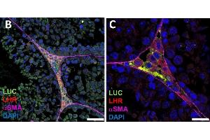 Luciferase expression in F1B-TMIR mouse testes.