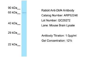 Western Blotting (WB) image for anti-DBF4 Homolog (DBF4) (C-Term) antibody (ABIN2784842) (DBF4 抗体  (C-Term))