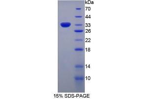 SDS-PAGE analysis of Human Spondin 1 Protein. (SPON1 蛋白)