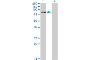 Western Blot analysis of DLG3 expression in transfected 293T cell line by DLG3 monoclonal antibody (M03), clone 2B6. (DLG3 抗体  (AA 281-380))