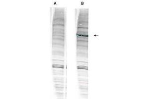 Western blot analysis is shown using  anti-Human WHIP antibody with and without pre-incubation with blocking peptide. (WRNIP1 抗体  (Internal Region, Isoform 1, Isoform 2))