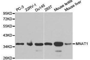 Western Blotting (WB) image for anti-Menage A Trois Homolog 1, Cyclin H Assembly Factor (Xenopus Laevis) (MNAT1) antibody (ABIN1873734) (MNAT1 抗体)