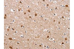 The image on the left is immunohistochemistry of paraffin-embedded Human brain tissue using ABIN7129189(DEFA6 Antibody) at dilution 1/40, on the right is treated with fusion protein.