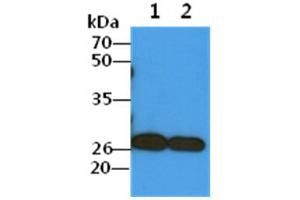 The Cell lysates (40ug) were resolved by SDS-PAGE, transferred to PVDF membrane and probed with anti-human COMMD7 antibody (1:1000). (COMMD7 抗体)