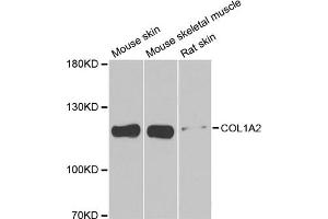 Western blot analysis of extracts of various cell lines, using COL1A2 antibody. (COL1A2 抗体)