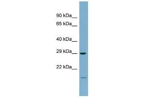 WB Suggested Anti-COPS7A Antibody Titration: 0. (COPS7A 抗体  (Middle Region))