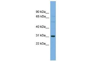 Western Blot showing SLCO1B1 antibody used at a concentration of 1-2 ug/ml to detect its target protein. (SLCO1B1 抗体  (Middle Region))