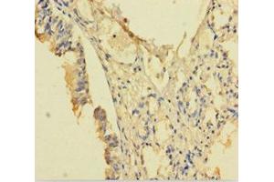 Immunohistochemistry (IHC) image for anti-Processing of Precursor 4, Ribonuclease P/MRP Subunit (POP4) (AA 1-220) antibody (ABIN7168126)