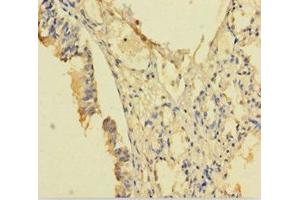 Immunohistochemistry of paraffin-embedded human lung tissue using ABIN7168126 at dilution of 1:100 (RPP29 抗体  (AA 1-220))