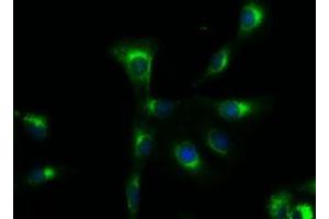 Immunofluorescent staining of A549 cells using anti-SOX17 mouse monoclonal antibody (ABIN2452377). (SOX17 抗体  (AA 177-414))