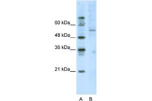 WB Suggested Anti-ATF7 Antibody Titration:  2. (AFT7 抗体  (C-Term))